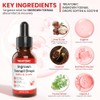 Ingrown Toenail Treatment Kit with Precision Clippers & Drops