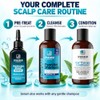 Sphagnum Botanicals Serum Para El Tratamiento De La Psoriasis Del
