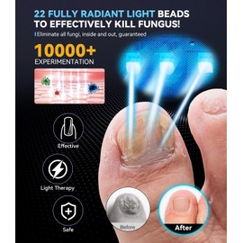 LOZLTX 8.0 Nail Pil Laser Device 21 Day Fast Acting Device for Multiple Toenails and Fingernails Industry No. 1 Laser 365 nm Infrared Light 405 nm Blue