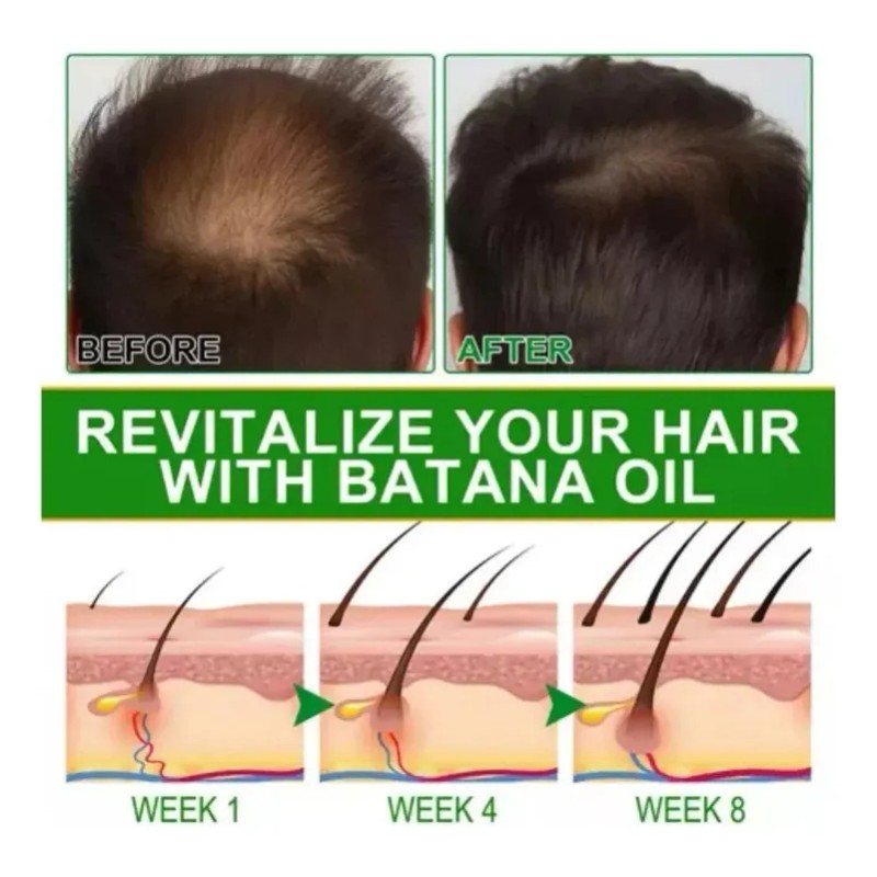 Aceite De Batana For El Crecimiento Del Cabello Con