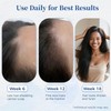 Hair Growth Serum for Thinning Hair | Strengthens & Thickens