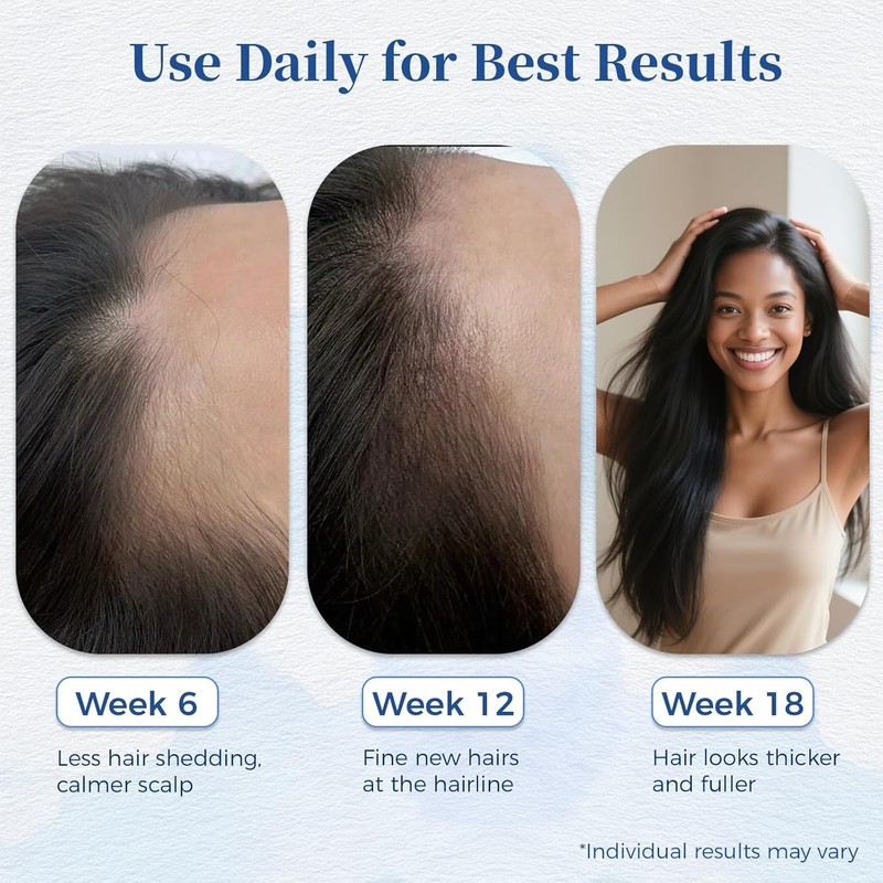 Hair Growth Serum for Thinning Hair | Strengthens & Thickens