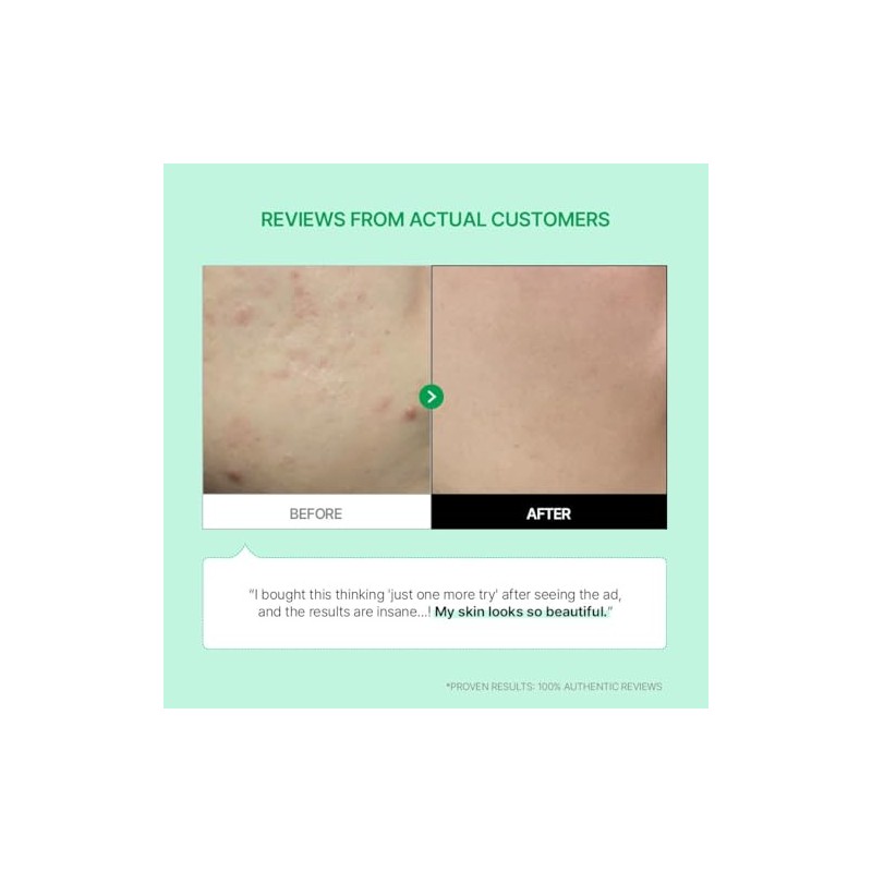 Parnell - Cicamanu 92 Serum 30ml