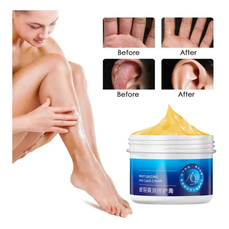 Crema Antisequedad Para Reparar Las Grietas De Los Pies Y