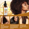5X Batana Oil Serum Hair Growth For Healthier Thicker&Stronger Fuller