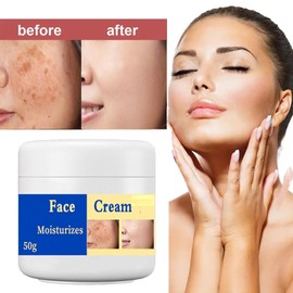 Spot Remover For Face Serum,Dark Spot Corrector Cream,Sun Spots and Melasma Freckle Remover,Spot Remover For Face Serum,Sun Spots and Melasma Treatment Cream for Face 50G