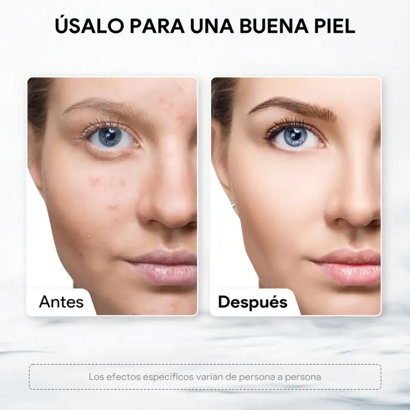 Kaisasa® Soluciones Y Kit Cuidado Facial As1 Sa2 Ao3 Hydradermabrasion