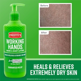 O'Keeffe's Working Hands Hand and Body Lotion, 12oz Pump (Pack of 1) - Heals and Relieves Extremely Dry Skin
