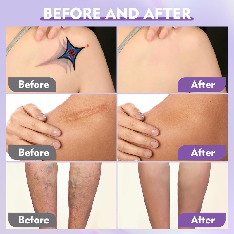 Body Coverage Perfector Waterproof, All Over Complexion Perfector with Extra