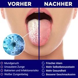 ORAVIX Zungenschaber Edelstahl | Dreier-Pack | Zungenreiniger | Für einen frischen Atem und eine bessere Mundgesundheit | Zungenreiniger Edelstahl | Zungenreiniger für Kinder und Erwachsene | ORAVIX