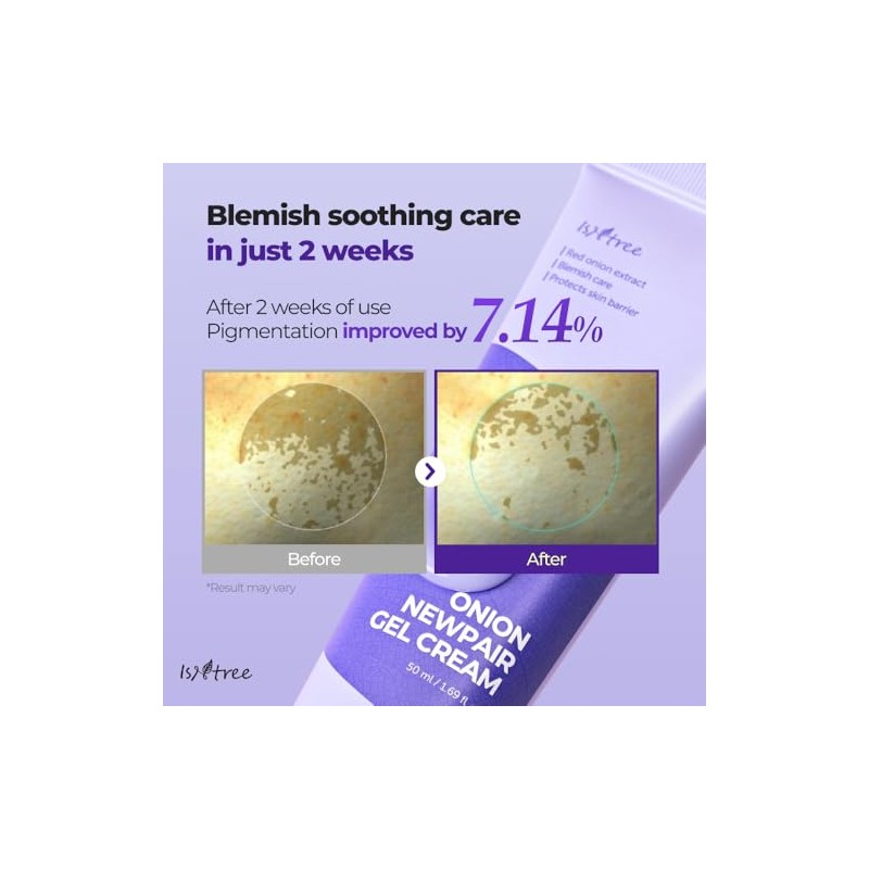 IsNtree Onion Newpair Gel Cream skin soothing,hydration,care acne spots and