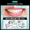 Dr. Oral 74801 Whitening Gel, Mint, 2.1 oz (60 g),