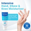 Dermal Therapy Hand Elbow & Knee Cream with 15% Urea