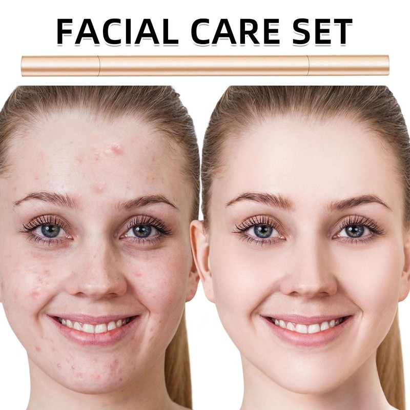 Mitesserentferner Milienöffner Komedonenquetscher, milien entferner, Edelstahl Lanzettennadel Akne, Pickel Pinzette