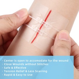 LotFancy Emergency Wound Closures, 4-Count, First Aid Supplies, Medical Butterfly Bandaids, Surgical Sutures Laceration Repair Kit with Accessories, Sterile, Latex-Free