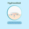 Hanhoo Extra Strength Blemish Patch Bundle - Salicylic Acid Treatment