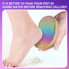 Foot File, Foot Files for Callus, Stainless Steel Callus Remover,