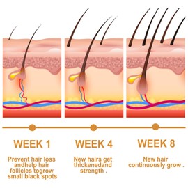 Hair Oil, Pack of 2 Hair Care Oil with Rice Extract, Hair Care Oil, Strengthening for Healthy Hair Growth, as and Hair Treatment, Used to Strengthen Hair and Repair Damaged Hair