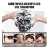 5 Minoxidil Shampoo Crecimiento Con Biotin Y Acondicionador