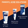 Panoxyl Panoxyl 4% Benzoyl Peroxide Pack of 2 Bundle