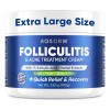 Crema Para El Tratamiento De La Foliculitis Y El Acné