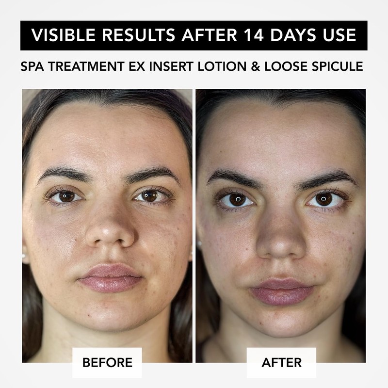 Spa Treatment eX Series Loose Spikle Gel Serum, 0.1 oz