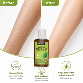 Hair Growth Inhibitor Gel for Smooth Skin – Gentle Herbal Aftercare for Underarms, Legs & Arms