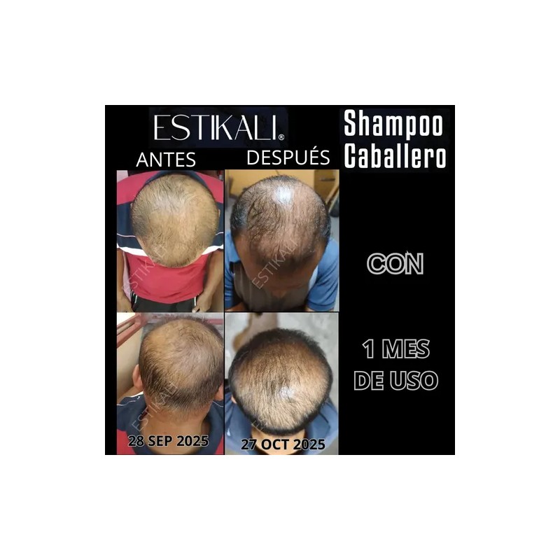 Shampoo Anticaída Anticaspa Antigraso Crecimiento De Cabello
