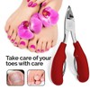 Professioneller Nagelknipser für dicke Fußnägel -