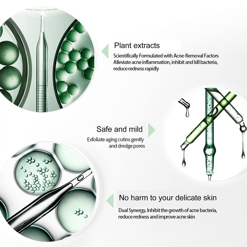 Skin Care Serum Plants Extracts Reduce Pimples Prevent Swelling Redness