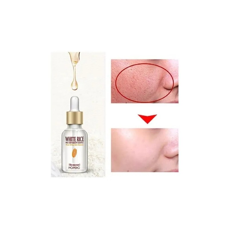 Serum Suave Blanquea Piel Aclara Suaviza Poros Moda Coreana Normal