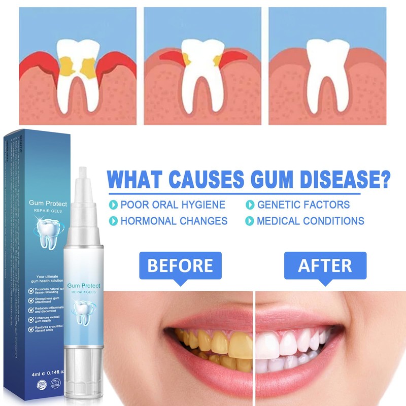 Landrain Gum Therapy Gel, Repair Gum Retention Pack of 5