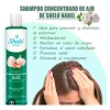Fortalece Cuero Cabelludo Shelo Nabel