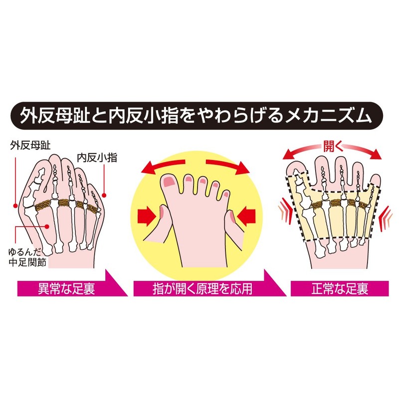 Alphax Bunion and Pinky Finger Supporter, Size M, For Left