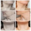 Neck Patch, Neck Wrinkle, Improving Pad, Neck Tape, Lifting, Fast