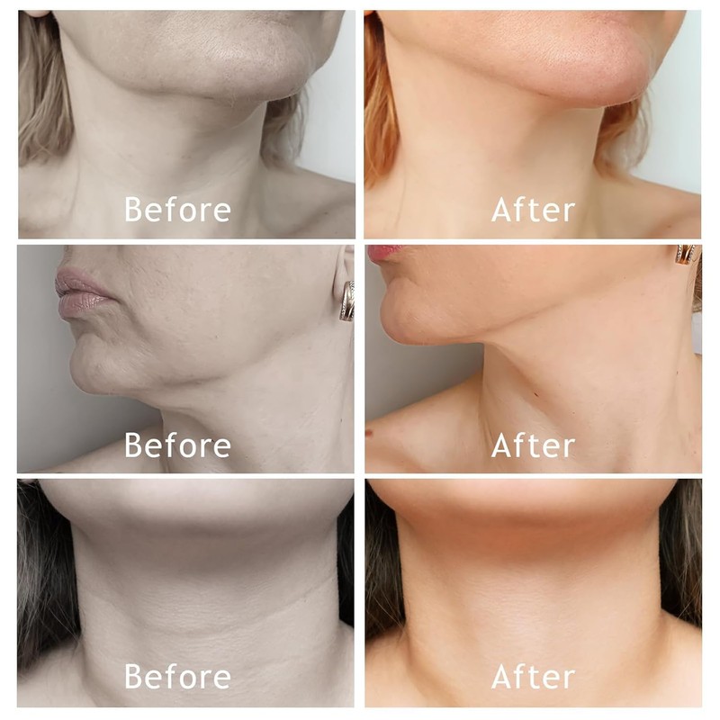Neck Patch, Neck Wrinkle, Improving Pad, Neck Tape, Lifting, Fast