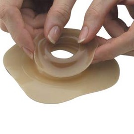 Adapt Hollister 79530 Skin Barrier Rings Adapt Convex (30mm) 1-3/16 by Unknown