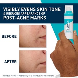 Serum Cerave Anti-Imprefecciones con Retinol para piel Grasa 30 ml