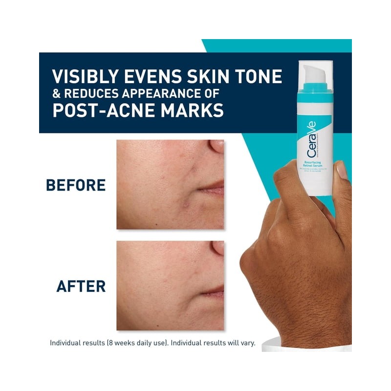 Serum Cerave Anti-Imprefecciones con Retinol para piel Grasa 30 ml