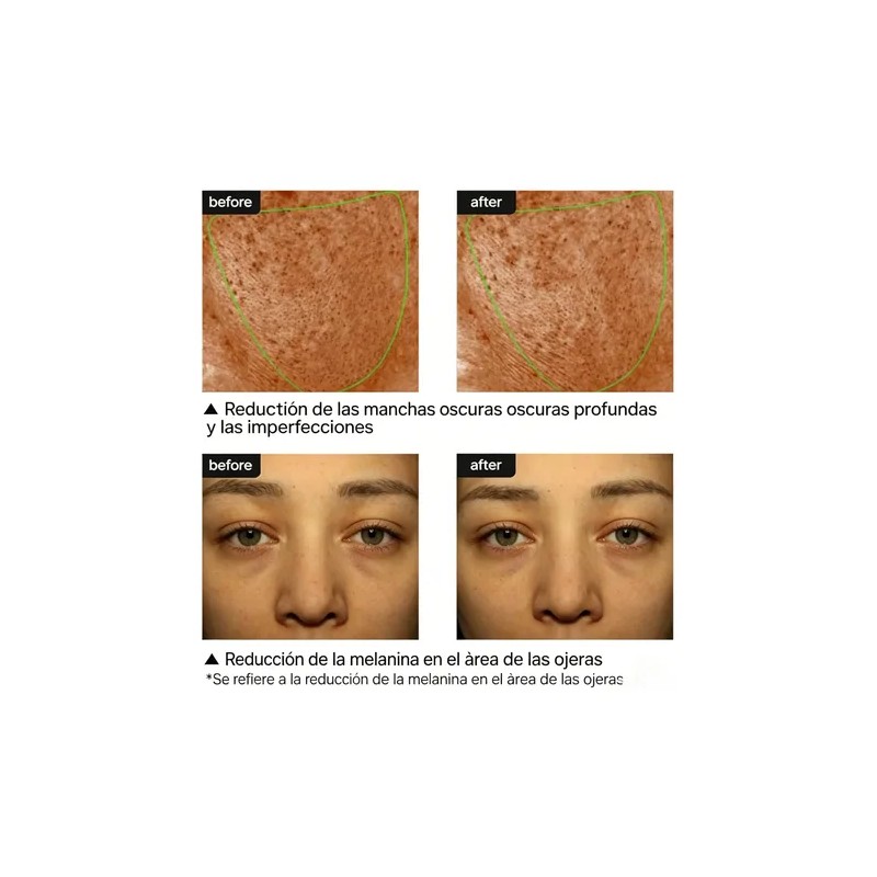 1pcs Crema Pore+dark Spot 35ml Piel Todo Todo Tipo De