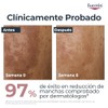 EUCERIN Anti-Pigment Crema Facial de Día FPS 30 50ml Efectiva