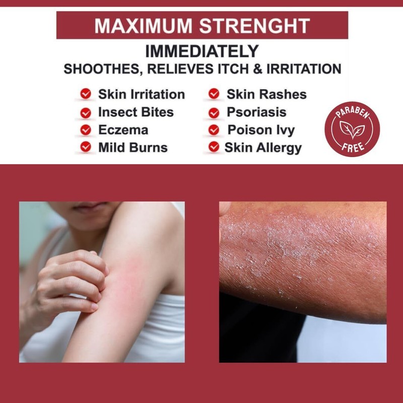 QUATRIDERM Fast Relief Hydrocortisone Cream for Eczema Itch Inflammation Aloe