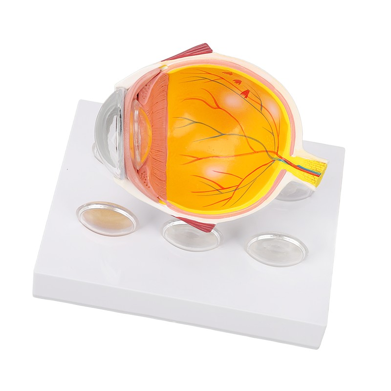 Enlarged Human Eye Anatomical Model Accurate Shows Optic Nerves Cornea