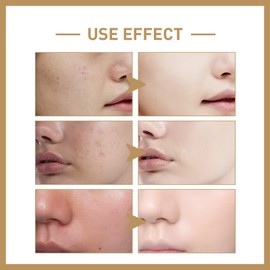 Vitamin C Multi Balm Stick,Brightening Serum Stick,Hydrating Serum Stick,Anti Wrinkle Seru-m S-tick,Balm Stick to Reduce Fine Lines,Vitamin C Eye B-alm Stic-k for Dark Circles,Dark Spot Remover