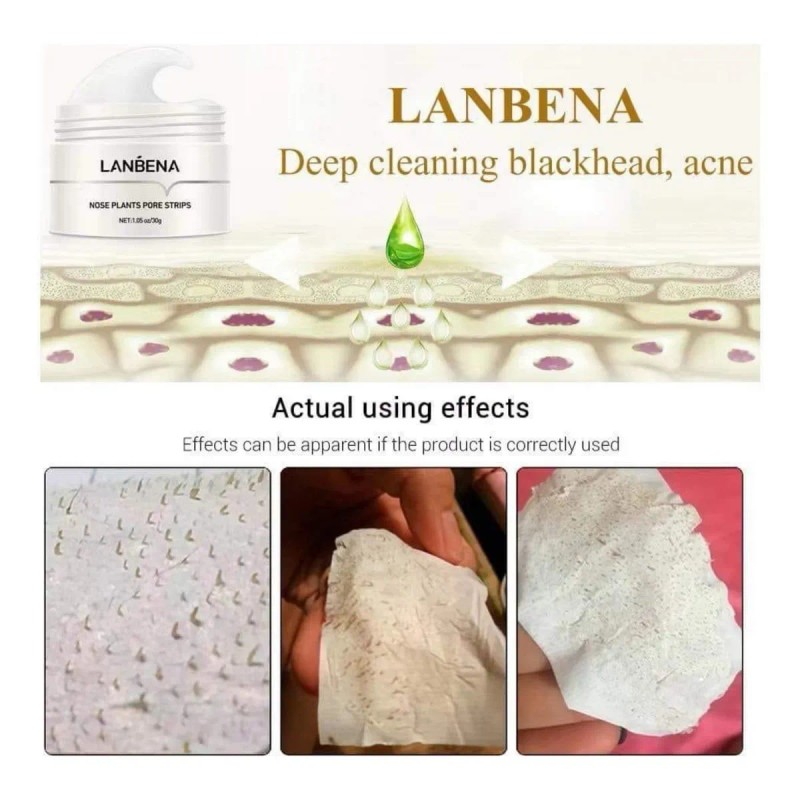 Kit Lanbena 2 cremas + 120 tiras, elimina puntos negros