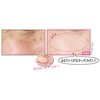 Chura Nachura Stain Kakushi Powder Cream Pact [0.3 oz (10