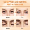 Crema De Ojos Reducción Ojeras Vitamina C Acido Hialuronico