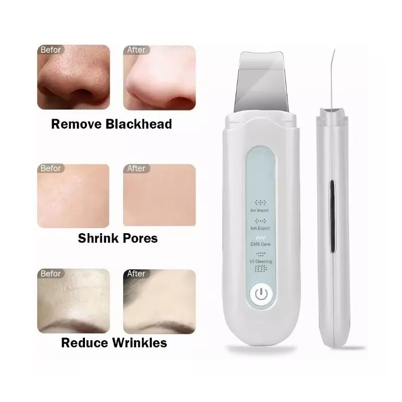 FanShen Scrubber, Ems, Eliminación Del Acné, Facial 3 Kit
