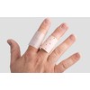 inocare Stacksche 386-5-11 Finger Splint for Buttonhole Fingers, Skin, Pack