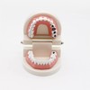 Dental Caries Study Tool Adult Standard Typodont Demonstration Teeth Model